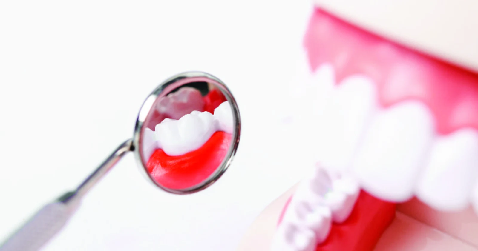 Ilustrasi untuk Hasil Penelitian: Nikotin Bukan Pemicu Gingivitis