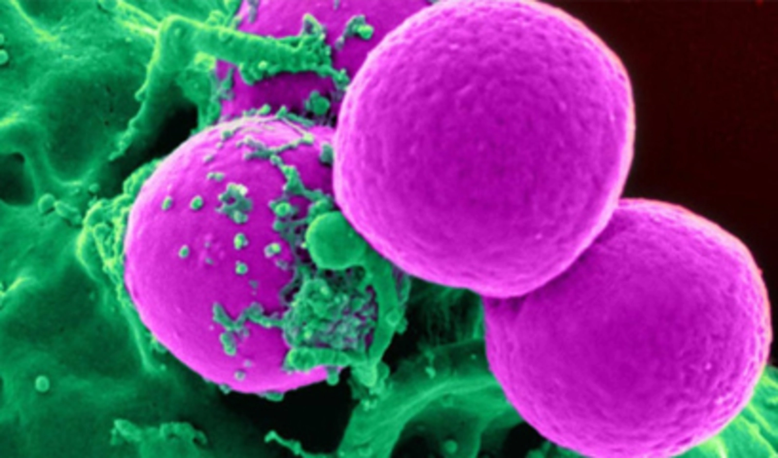 Ilustrasi untuk Uap Tembakau Modifikasi Risiko dan Dampak Sel Tubuh