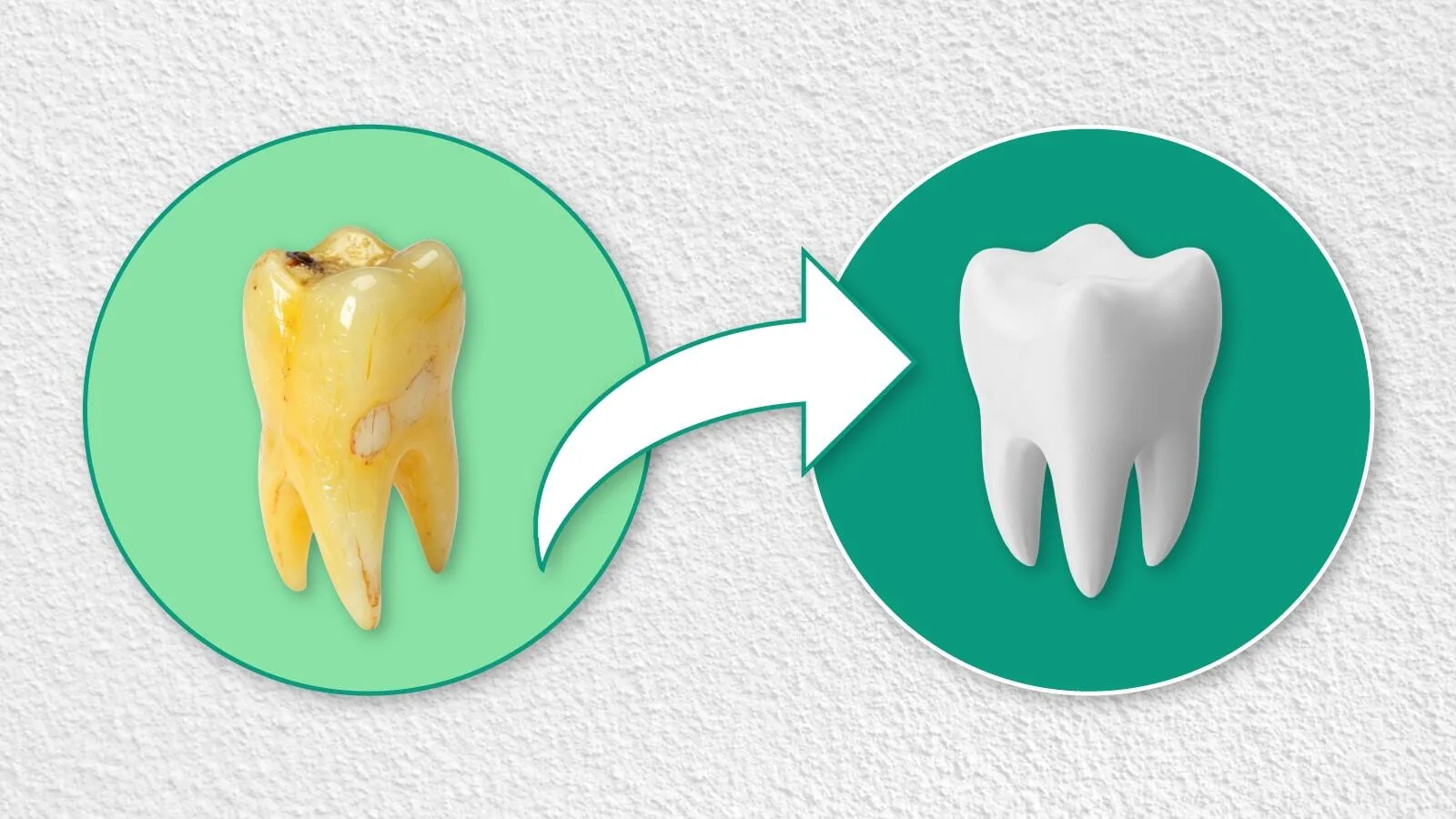 Ilustrasi untuk Cara Menghilangkan Nikotin di Gigi: Solusi Aman untuk Senyum Lebih Cerah