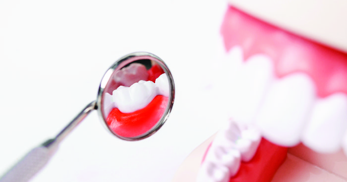 Ilustrasi untuk Hasil Penelitian: Nikotin Bukan Pemicu Gingivitis