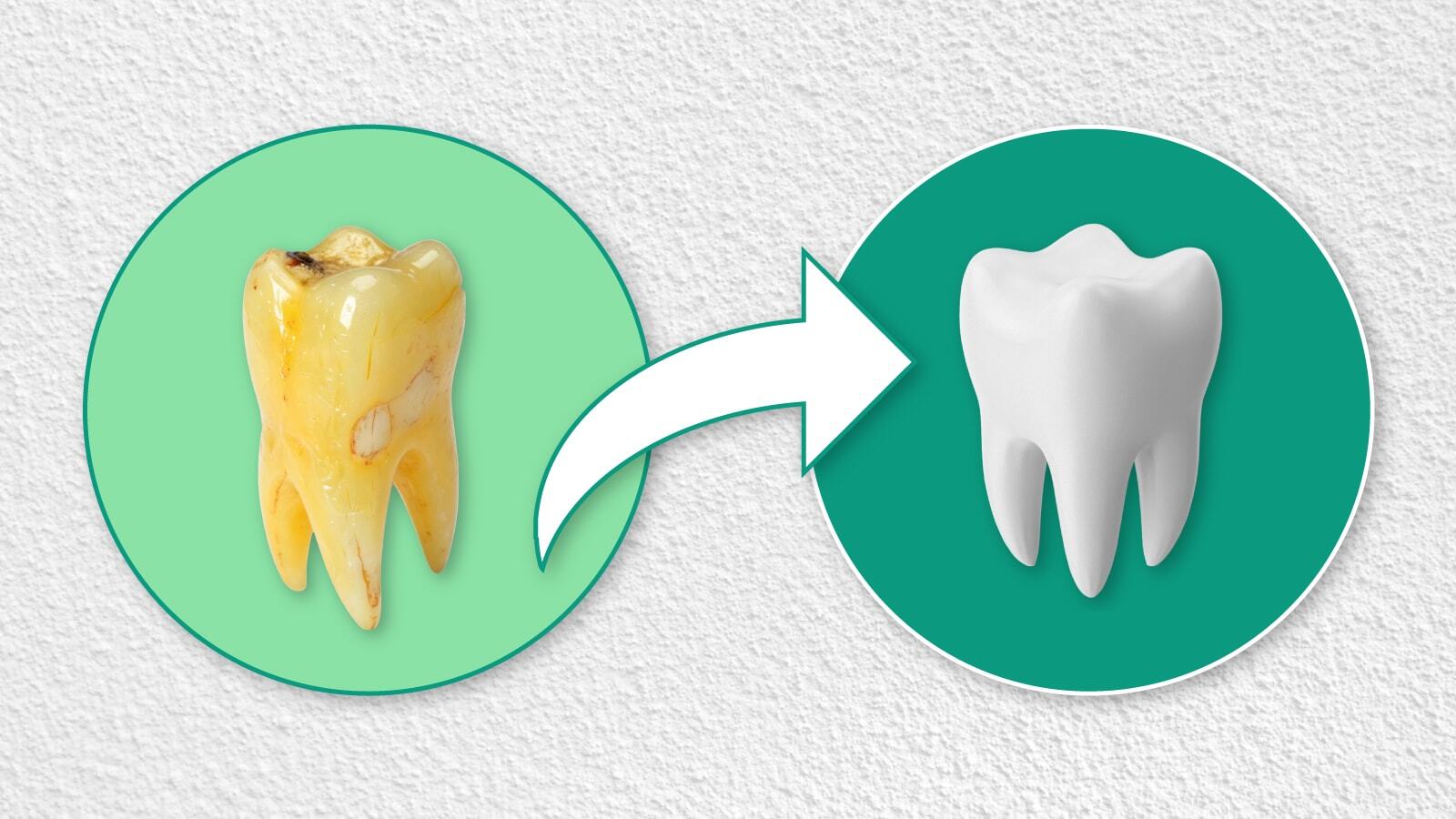 Ilustrasi untuk Cara Menghilangkan Nikotin di Gigi: Solusi Aman untuk Senyum Lebih Cerah